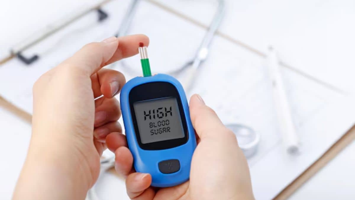 Description of the pic