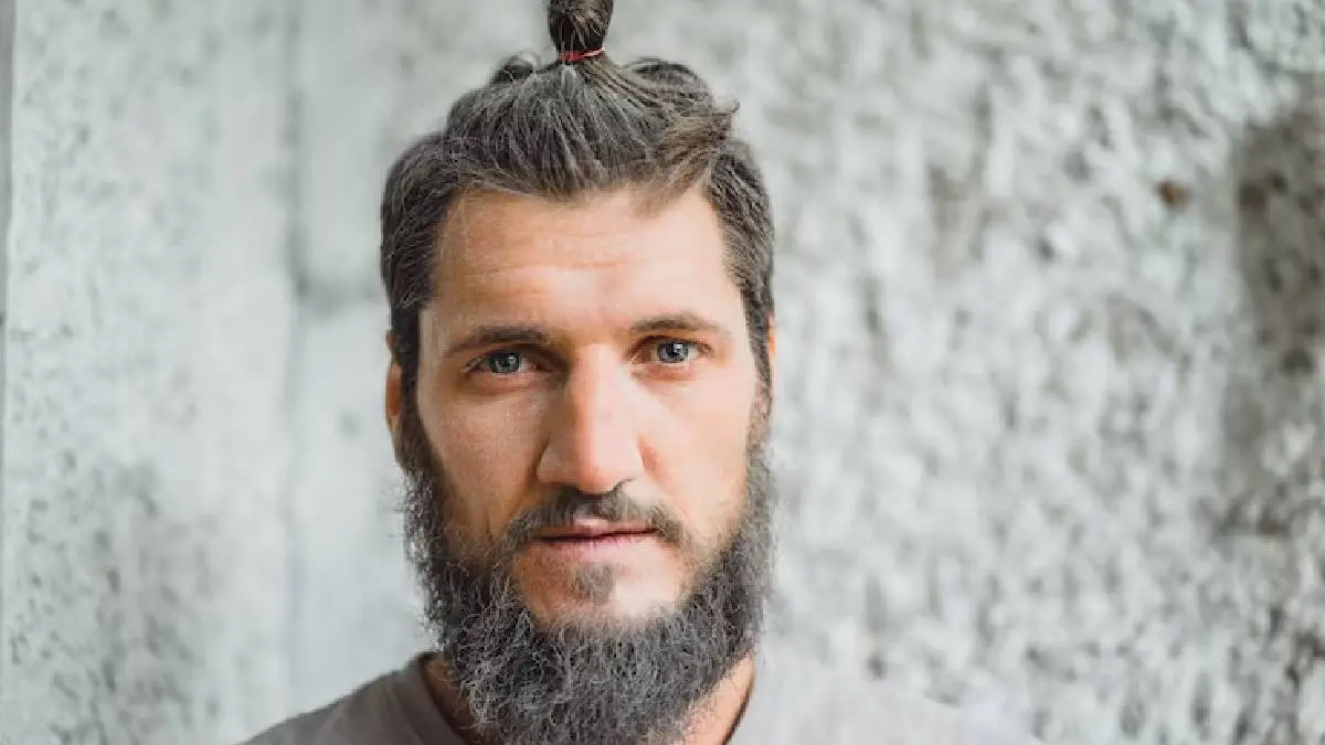 What diseases cause premature grey hair