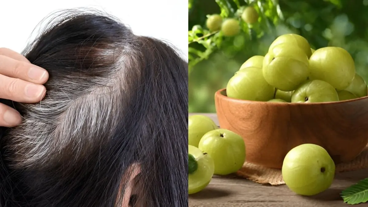 white to black hair home remedy using amla and coconut oil safed balo ko kala karne ke upay