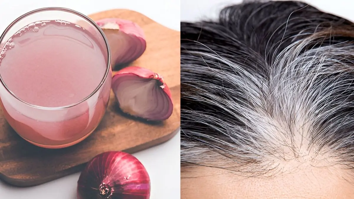 white to black hair remedy using onion juice and amla powder on scalp and length pyaj ke ras ko balo mei lagane ke fayde