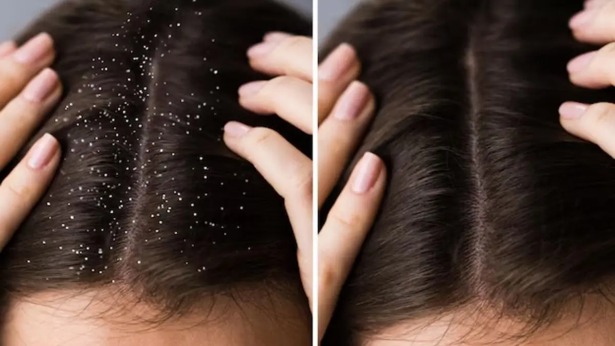 White to Black Hair Tips