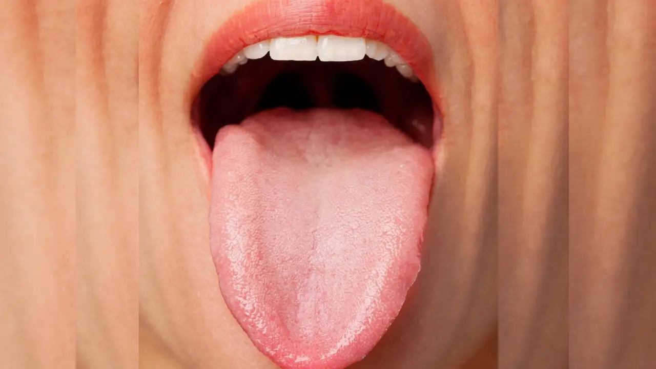white tongue causes in hindi