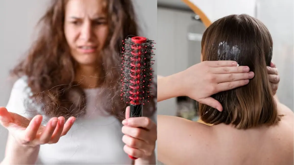 Winter Hairfall Control Tips