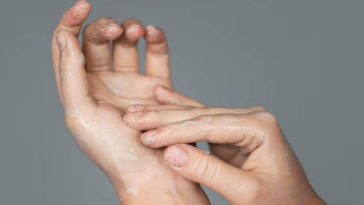 Winter Hand Care Tips