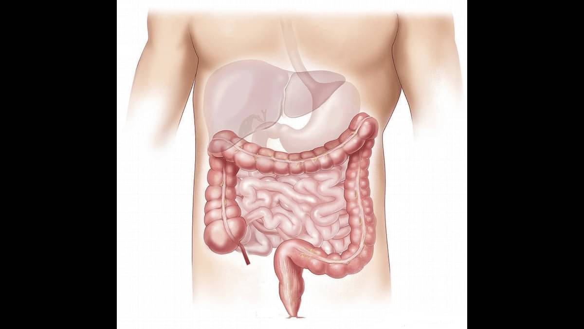 World Liver Day 2025: 6 Foods That Are Worst For Your Liver