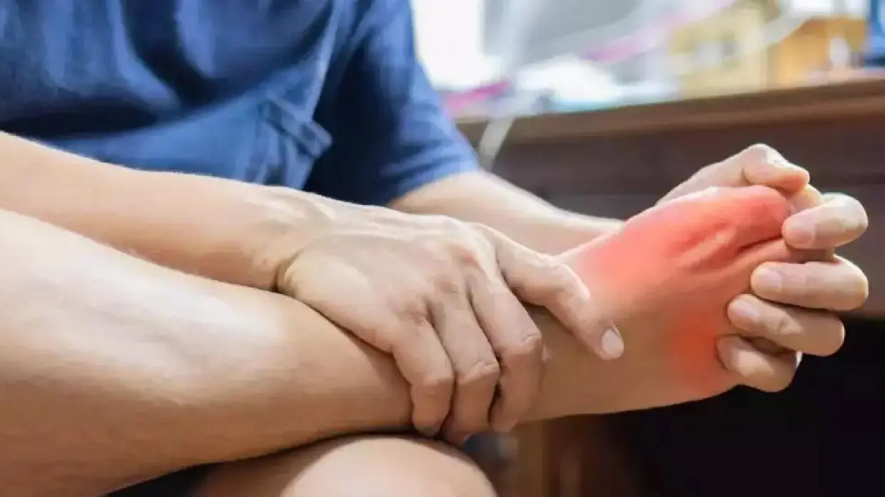 यूरिक एसिड लेवल को कम करने के उपाय (फोटो : shutterstock)