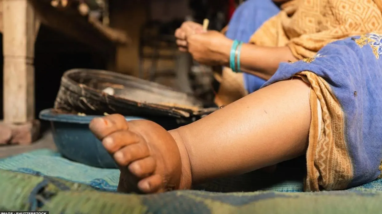 How To Avoid Filariasis