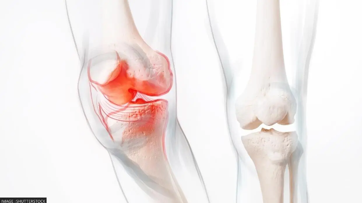 हड्डियों को कमजोर करती हैं ये आदतें (फोटो : Shutterstock)