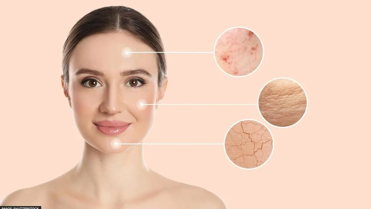 विंटर स्किन केयर टिप्स (फोटो : Shutterstock)