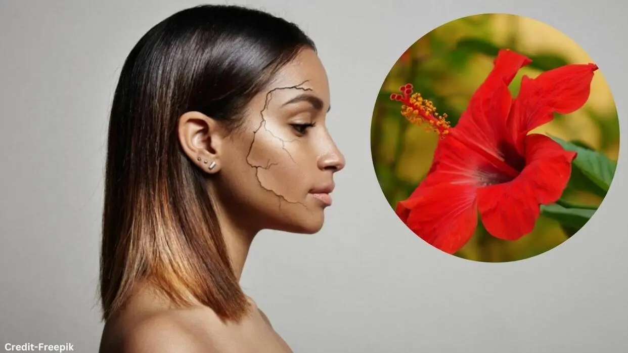 Hibiscus Flower Face Pack For Dry Skin
image- freepik