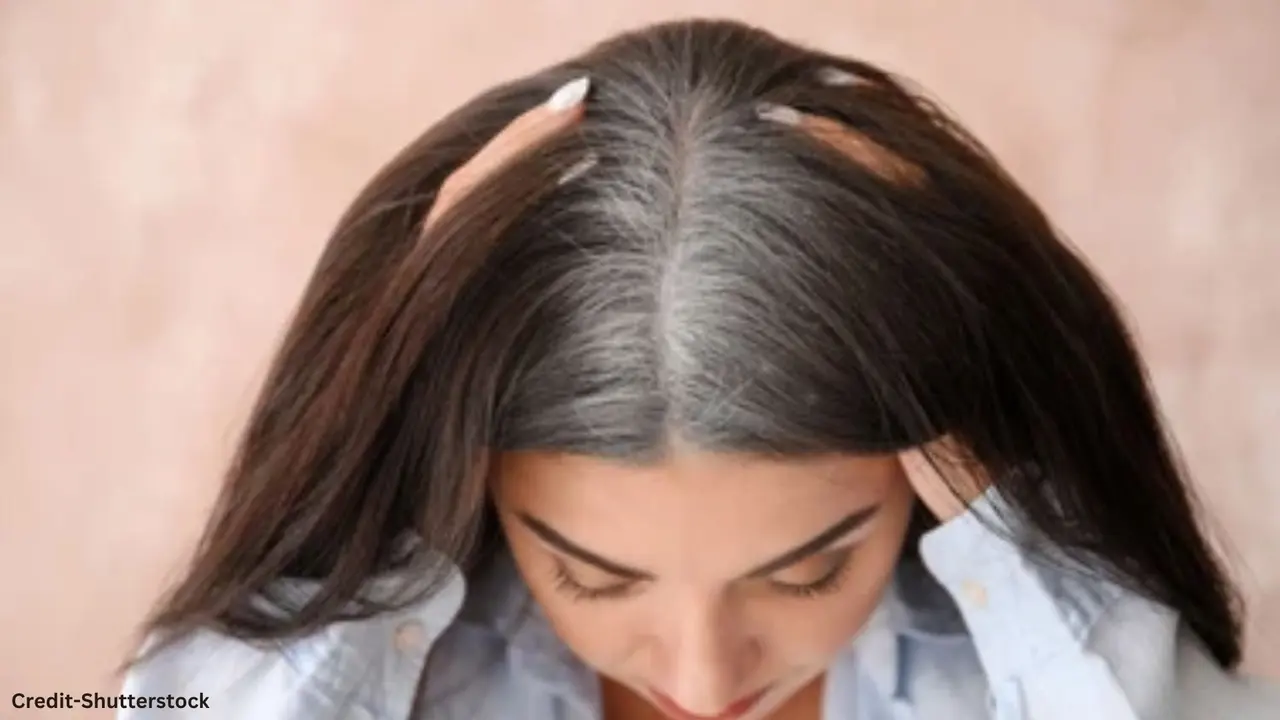 White Hair Problem Home Remedies