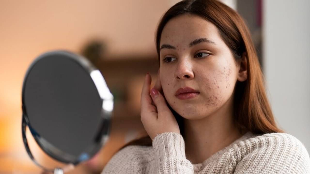 Description of the pic