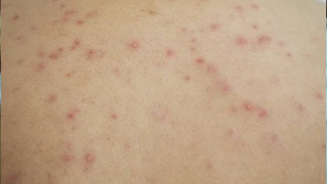 Description of the pic