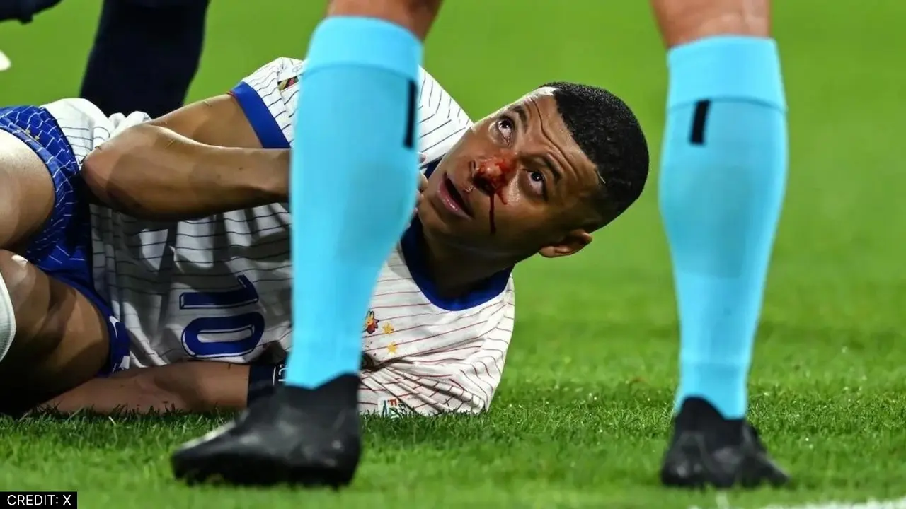 France Star Footballer Kylian Mbappe Nose Fracture in EURO 2024