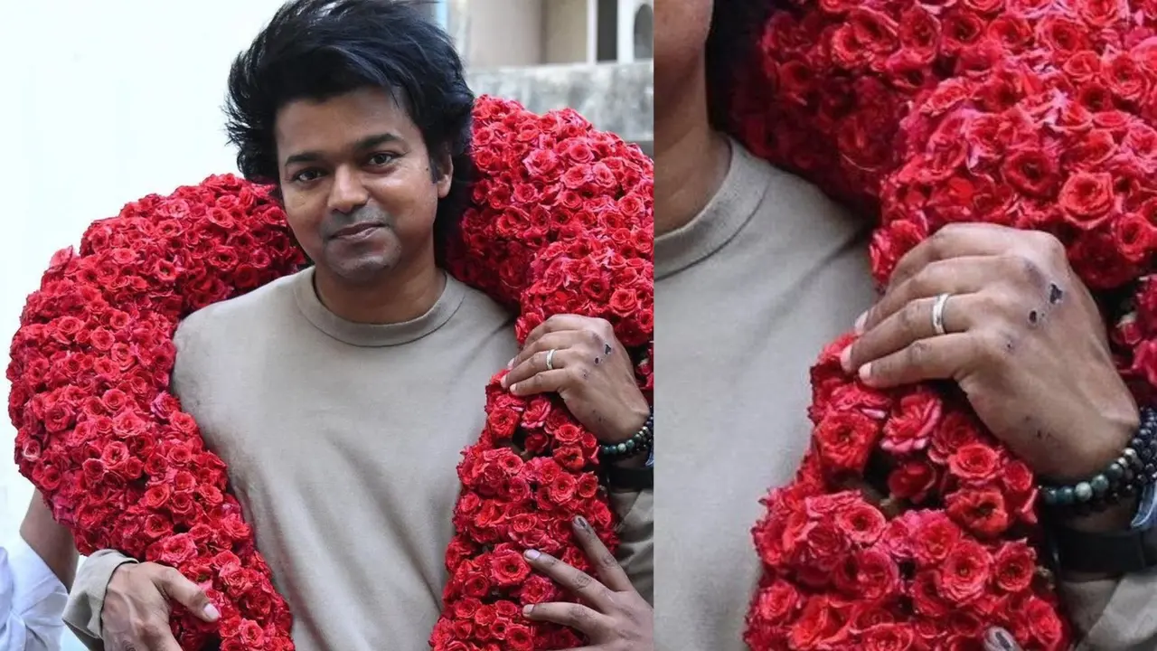 thalapathy vijay injured