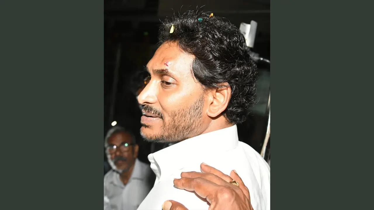 CM Jagan Mohan Reddy got injured