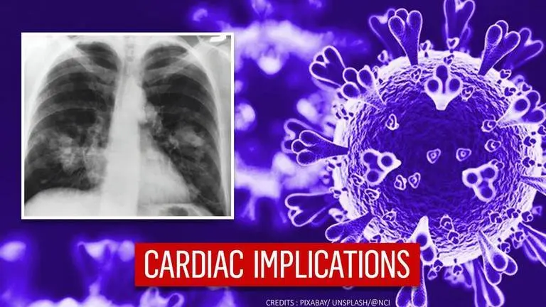 COVID-19 recovered patients prone to cardiac damage due to rise in troponin levels: Study COVID-19
