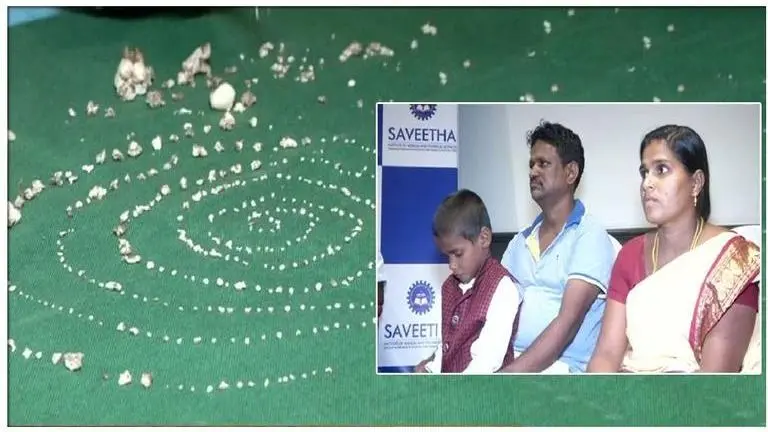 Seven-year-old boy has 526 teeth removed his jaw, doctors claim it is world's first case Seven-year-old boy has 526 teeth removed his jaw, doctors claim it is world's first case