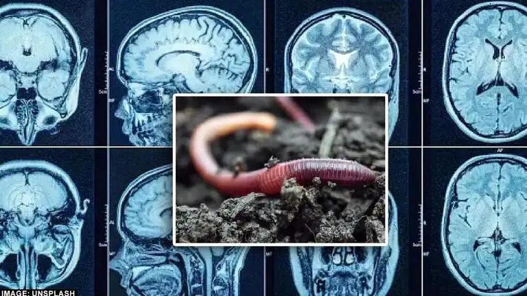In a world's first, doctors discover live worm in 64-year-old Australian woman's brain Australia worm woman brain