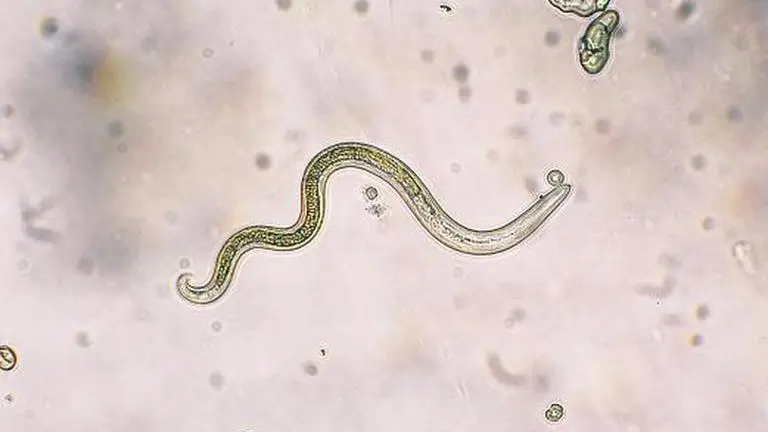In Vietnam, doctors find parasitic worms crawling under woman's skin & buried in her brain Vietnam