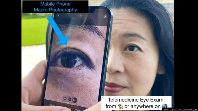 Doctor uses iPhone 13 Pro Max to click macro shots of patients eye for check up