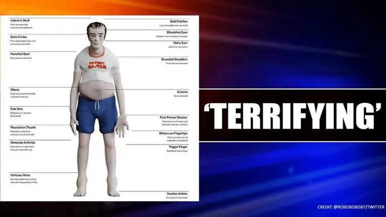 Gaming disorder: This is what avid gamers could look like in 20 years