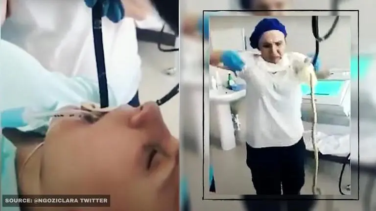 Snake pulled out from woman's mouth