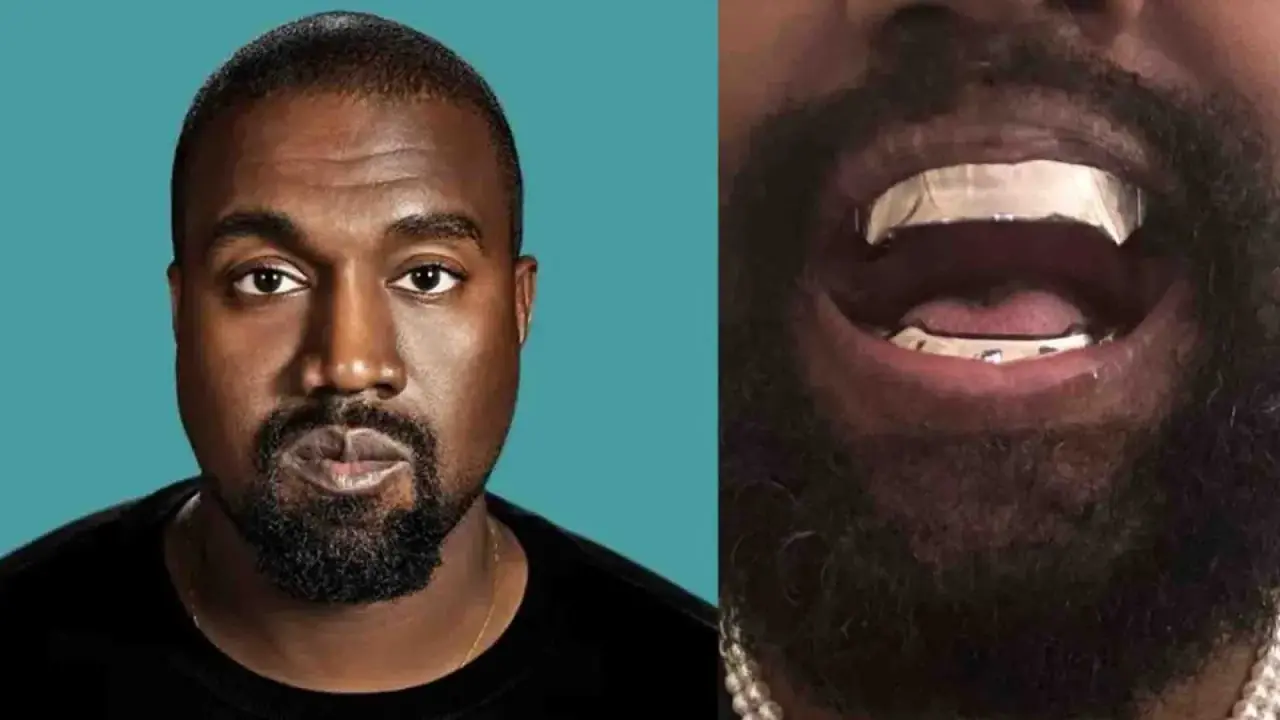 Kanye West Replaces His Teeth With Titanium Dentures 'More Expensive Than Diamonds' A file photo of Kanye West