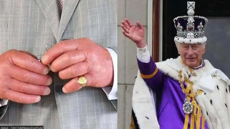 King Charles' 'Sausage Fingers': What is the mystery behind monarch's swollen hands King Charles