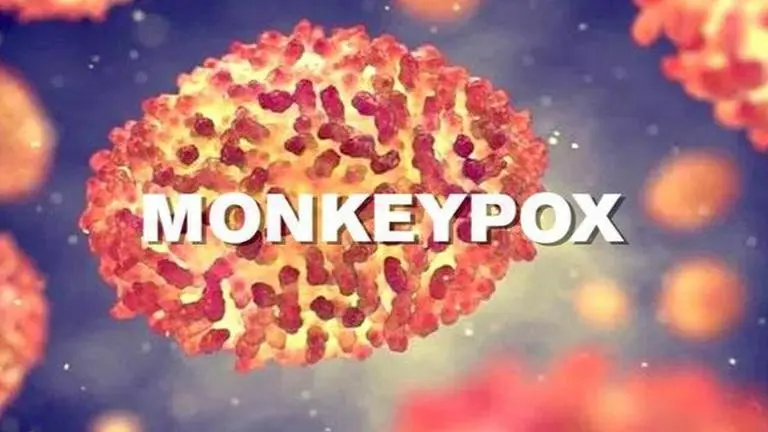 Monkeypox: UKHSA warns patients to avoid contact with pets, rodents to be tested Monkeypox