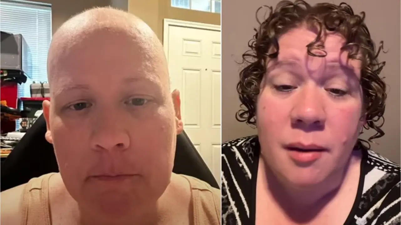 Shocking: Post Chemotherapy, Woman Told She Was Misdiagnosed With Cancer Post chemotherapy, woman told she was misdiagnosed with cancer