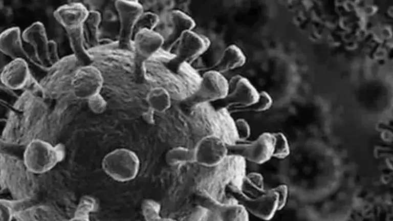 3 more test Covid-19 positive in Assam; cases rise to 62