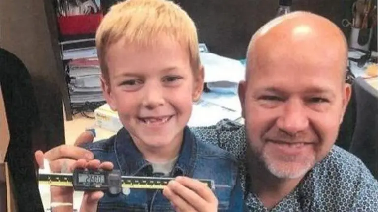 Canada: 9-year-old boy sets world record of longest milk tooth extracted, feels 'honoured' Main Image Credits: guinnessworldrecords.com