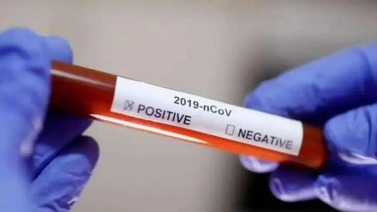 Chandigarh COVID-19 tally reaches 302