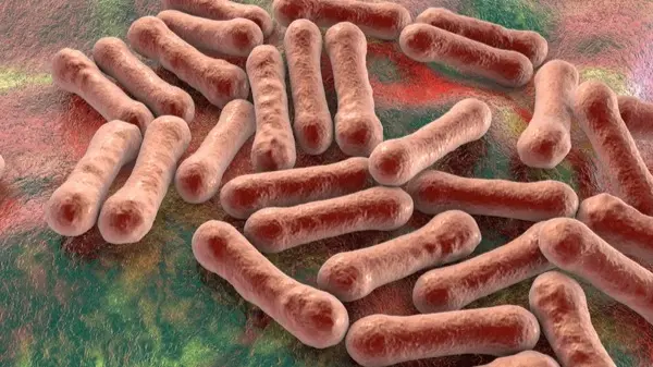 Diphtheria Outbreak in Odisha. All You Need to Know What is Diphtheria