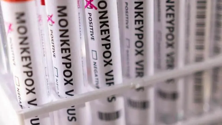 Monkeypox symptoms in UK patients differ from those observed in previous outbreaks: Study Monkeypox