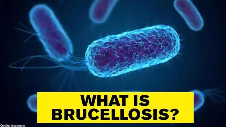 Brucellosis outbreak