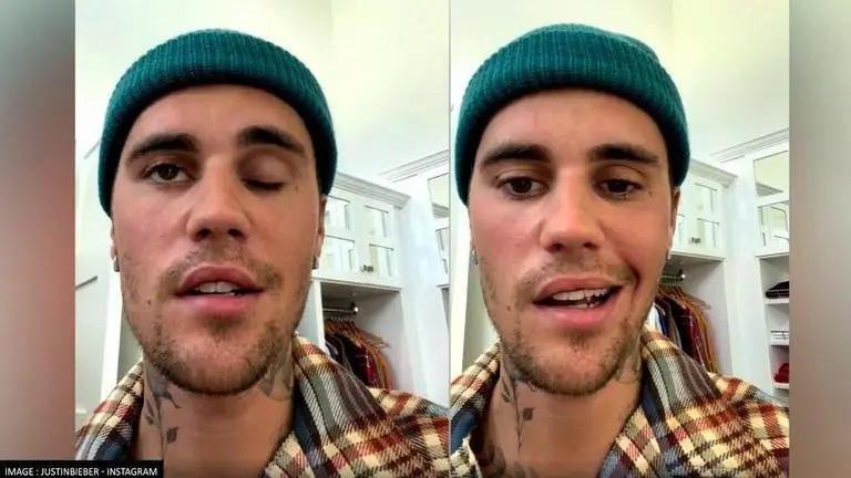 What is Ramsay Hunt Syndrome? Know all about its symptoms, causes, early detection & more ramsay hunt syndrome