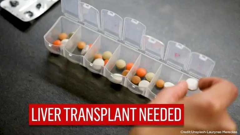 Woman with rare disease needs liver transplant as she gets drunk without consuming alcohol US: Woman with rare disease gets drunk without consuming alcohol | Read