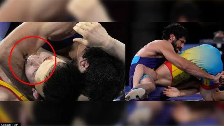 Ravi Dahiya overcame Kazak opponent's full-jawed bite to guarantee India an Olympics medal Ravi Kumar Dahiya/Tokyo Olympics