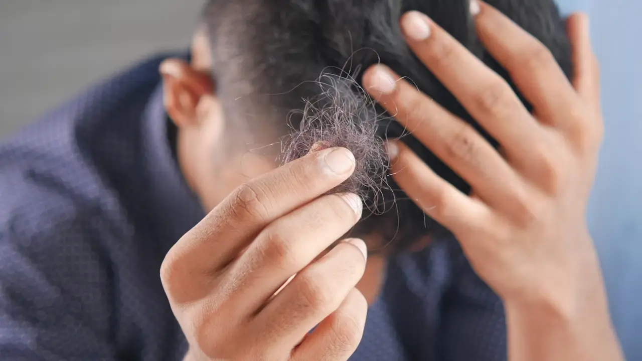 Turkey Emerges as Top Destination For Hair Loss Treatment - All You Need To Know Hair loss