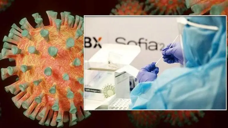 AI tool uses chest X-ray to identify & differentiate worst cases of COVID-19 AI