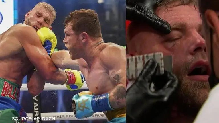 Billy Joe Saunders injury update: Boxer set for lengthy absence after eye surgery billy joe saunders injury update