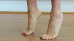 Flat feet