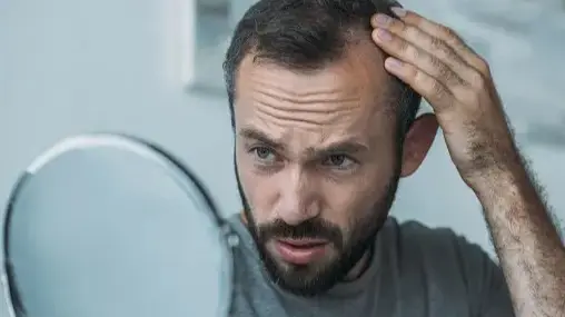 All You Need To Know To Reduce Hair Thinning In Men