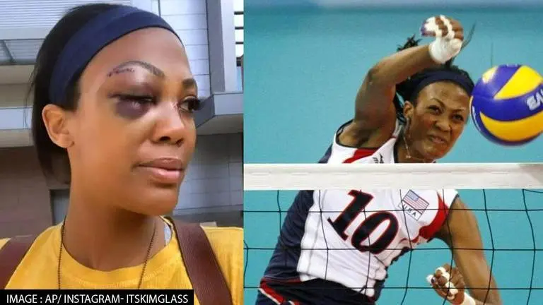 Ex-Olympian Kim Glass recalls brutal attack by homeless man that caused facial fractures Kim Glass