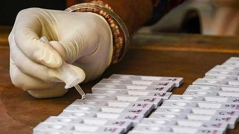 CT score in COVID-19 result: What it means in RT-PCR report & what is the normal score? ct score, COVID-19