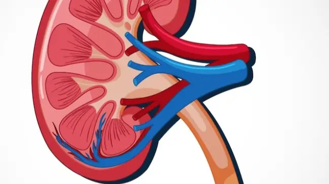 Foods To Avoid If You Are Prone To Kidney Stones: Salty Foods To Animal Proteins Kidney Stones