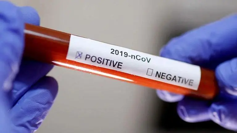 2 more test COVID-19 positive in UP's Shamli district