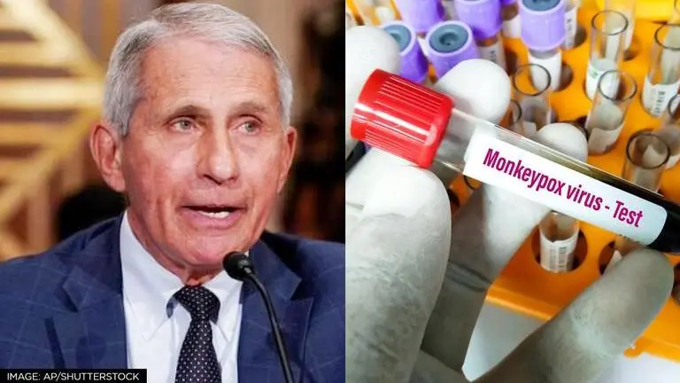 US chief medical advisor Fauci stresses on need to understand 'profound risk' of monkeypox US